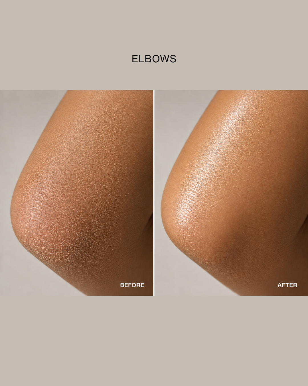 O.R.G Mineral Peel Body | Gentle K-Beauty Body Exfoliator