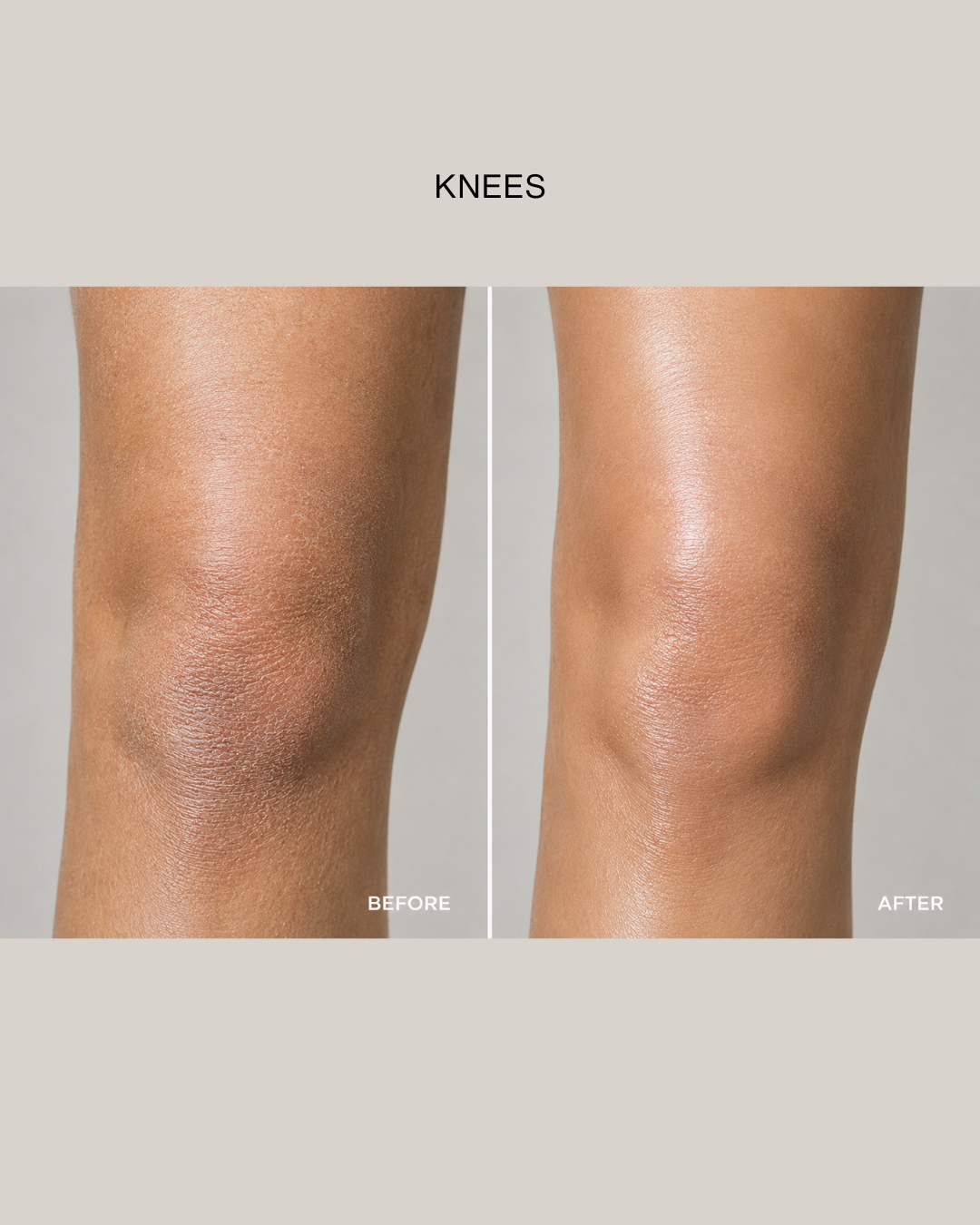 O.R.G Mineral Peel Body | Gentle K-Beauty Body Exfoliator